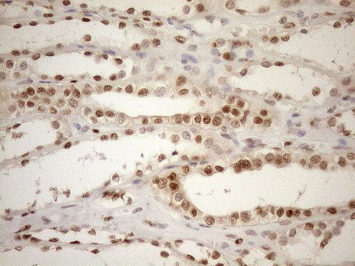 MGMT Antibody in Immunohistochemistry (Paraffin) (IHC (P))