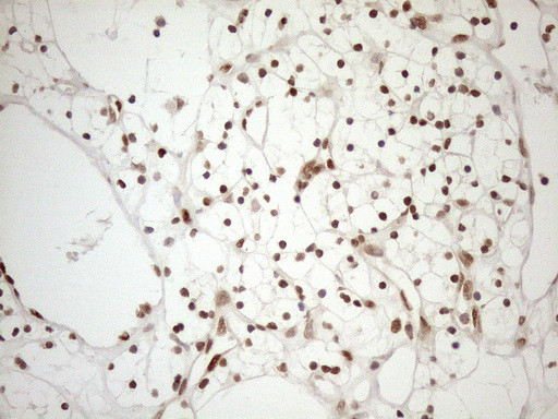 MGMT Antibody in Immunohistochemistry (Paraffin) (IHC (P))