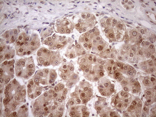 MGMT Antibody in Immunohistochemistry (Paraffin) (IHC (P))