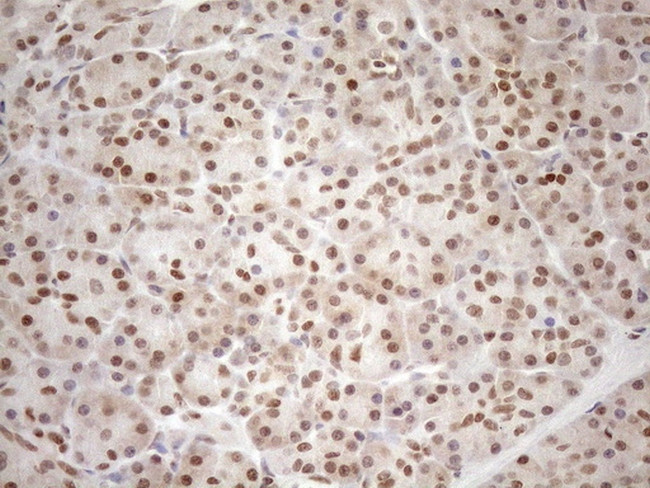 MGMT Antibody in Immunohistochemistry (Paraffin) (IHC (P))