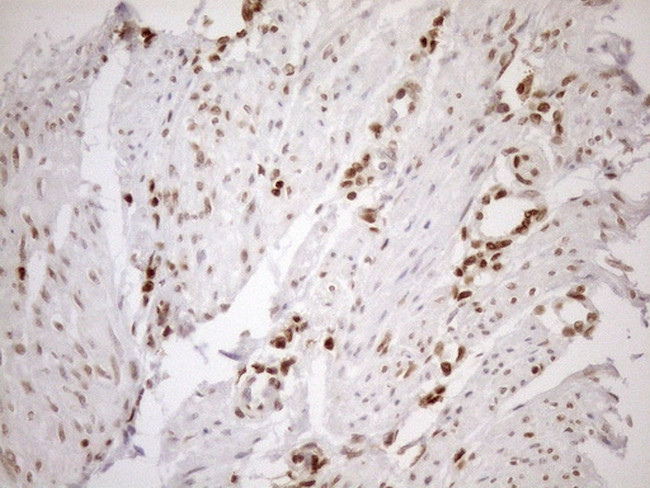 MGMT Antibody in Immunohistochemistry (Paraffin) (IHC (P))