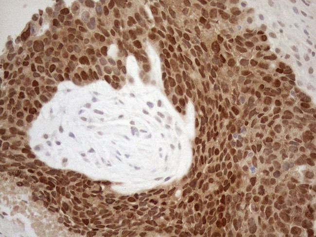 MGMT Antibody in Immunohistochemistry (Paraffin) (IHC (P))