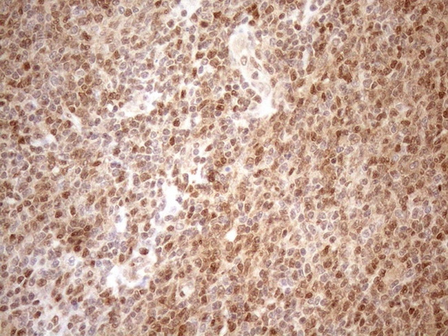 MGMT Antibody in Immunohistochemistry (Paraffin) (IHC (P))