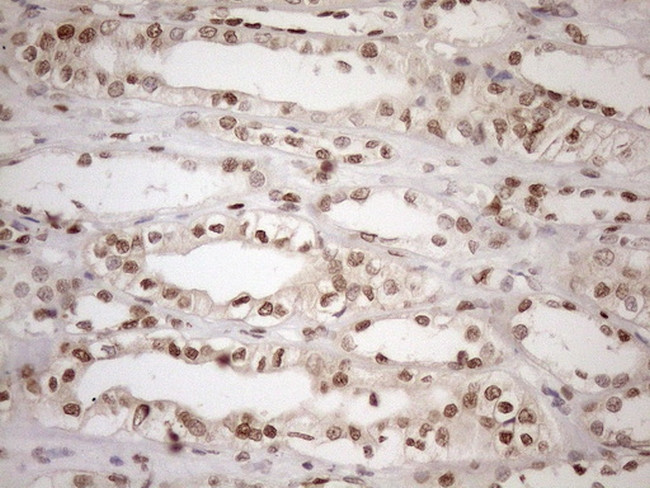 MGMT Antibody in Immunohistochemistry (Paraffin) (IHC (P))