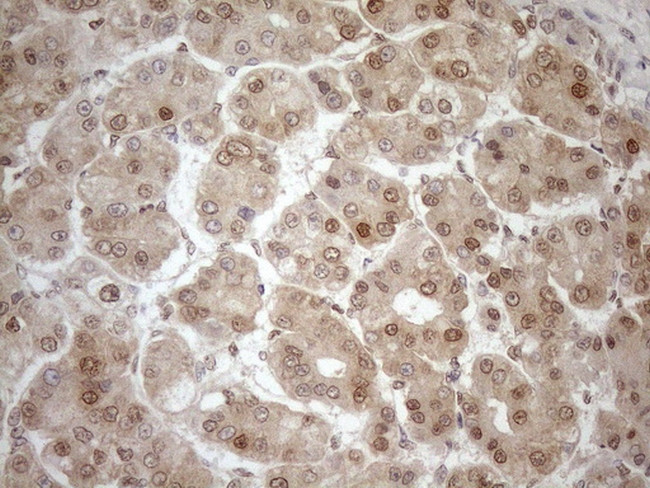 MGMT Antibody in Immunohistochemistry (Paraffin) (IHC (P))