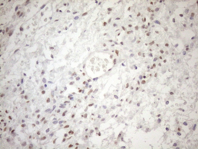 MGMT Antibody in Immunohistochemistry (Paraffin) (IHC (P))