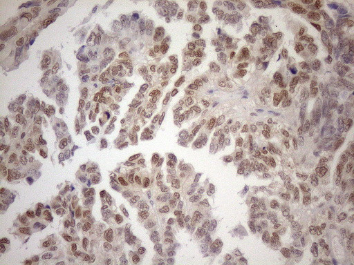 MGMT Antibody in Immunohistochemistry (Paraffin) (IHC (P))