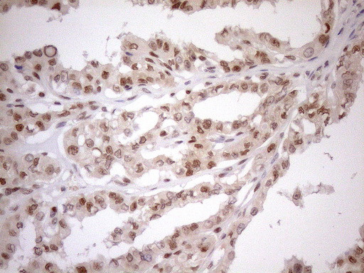 MGMT Antibody in Immunohistochemistry (Paraffin) (IHC (P))