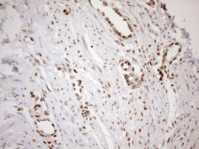 MGMT Antibody in Immunohistochemistry (Paraffin) (IHC (P))