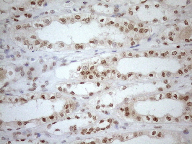 MGMT Antibody in Immunohistochemistry (Paraffin) (IHC (P))