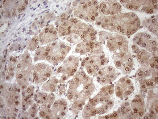 MGMT Antibody in Immunohistochemistry (Paraffin) (IHC (P))