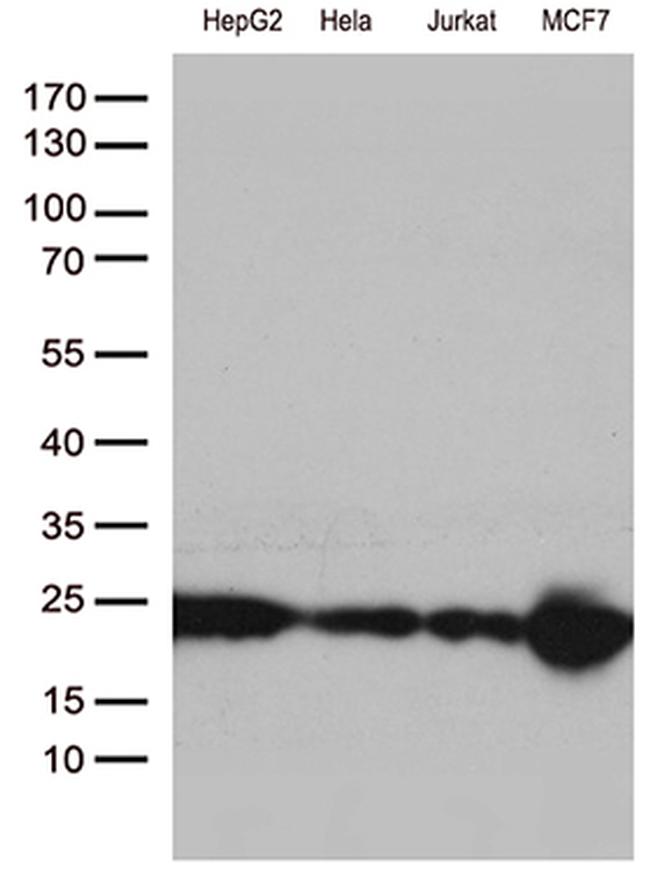 MGMT Antibody in Western Blot (WB)