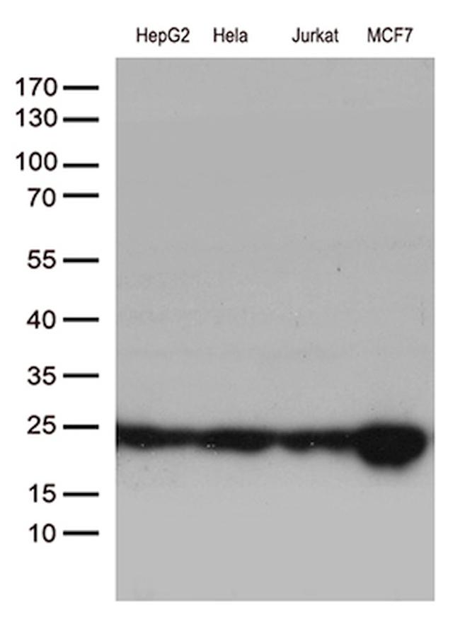 MGMT Antibody in Western Blot (WB)