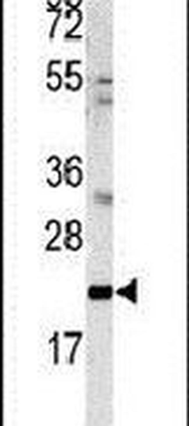 MGMT Antibody in Western Blot (WB)