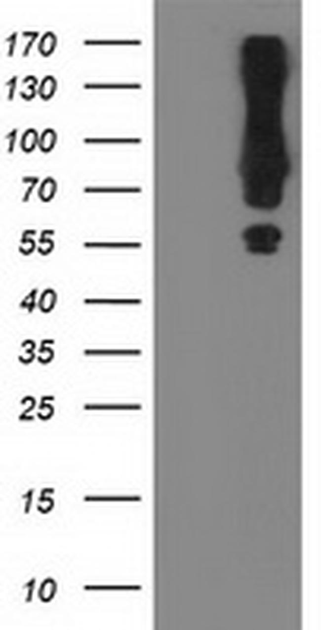 MGRN1 Antibody in Western Blot (WB)