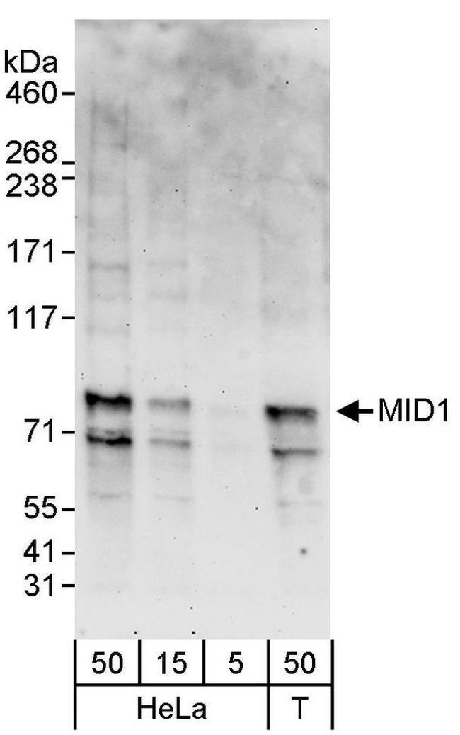 MID1 Antibody in Western Blot (WB)