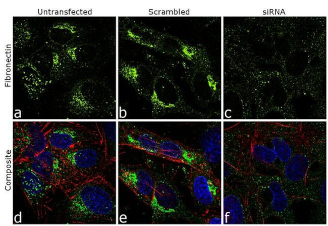 Fibronectin Antibody in Immunocytochemistry (ICC/IF)