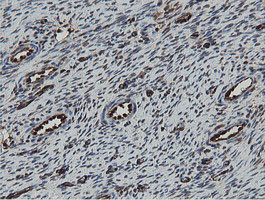 MIPEP Antibody in Immunohistochemistry (Paraffin) (IHC (P))