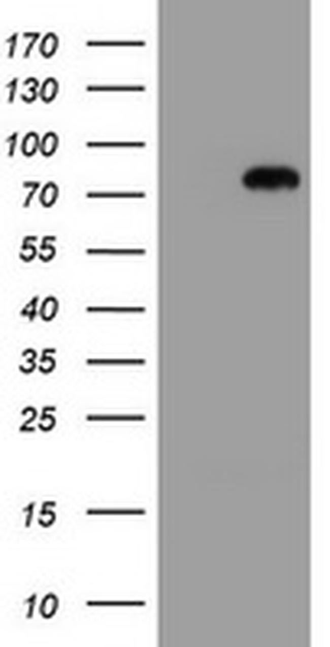 MIPEP Antibody in Western Blot (WB)