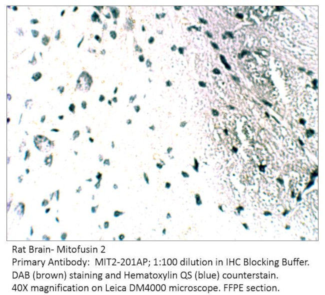 Mitofusin 2 Antibody in Immunohistochemistry (IHC)