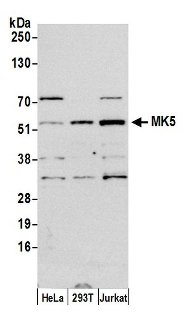 MK5 Antibody in Western Blot (WB)