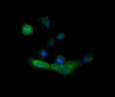 MLANA Antibody in Immunocytochemistry (ICC/IF)