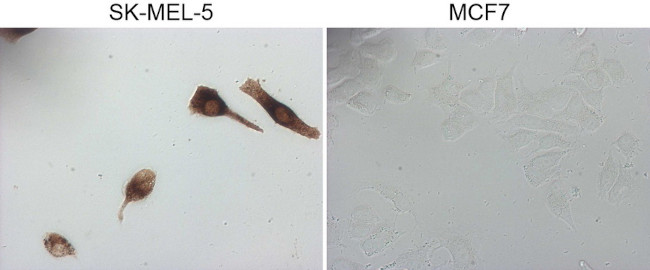 MLANA Antibody in Immunocytochemistry (ICC/IF)