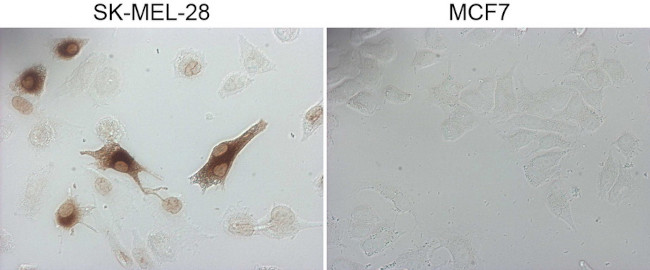 MLANA Antibody in Immunocytochemistry (ICC/IF)