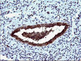 MLANA Antibody in Immunohistochemistry (Paraffin) (IHC (P))