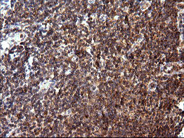 MLANA Antibody in Immunohistochemistry (Paraffin) (IHC (P))