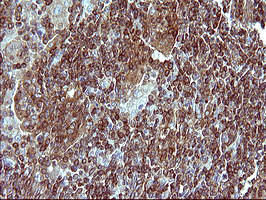 MLANA Antibody in Immunohistochemistry (Paraffin) (IHC (P))