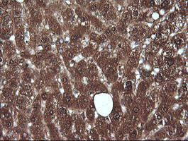 MLANA Antibody in Immunohistochemistry (Paraffin) (IHC (P))