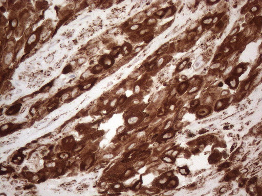 MLANA Antibody in Immunohistochemistry (Paraffin) (IHC (P))