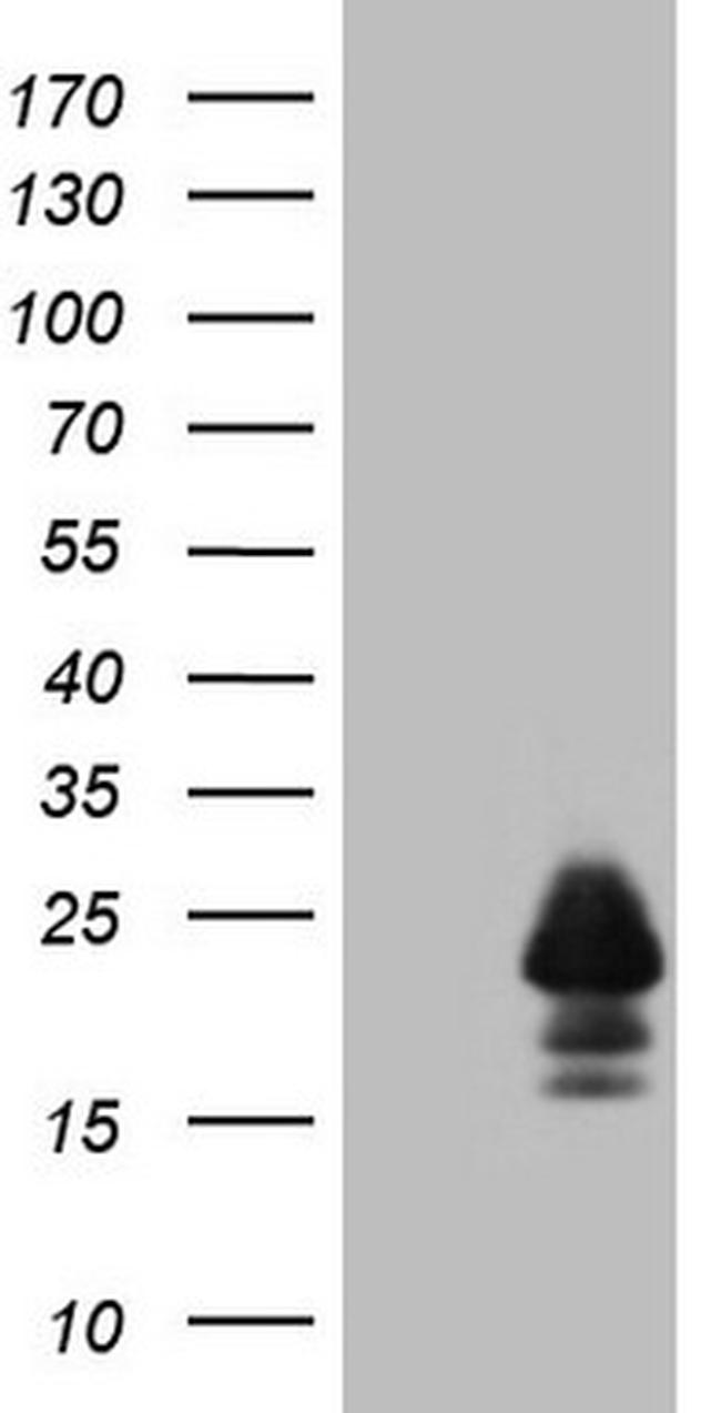 MLANA Antibody in Western Blot (WB)