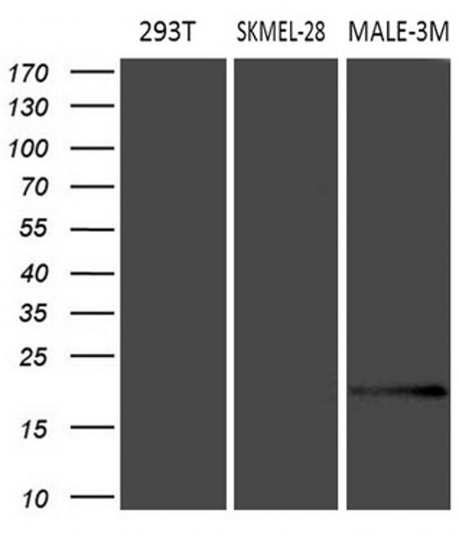 MLANA Antibody in Western Blot (WB)