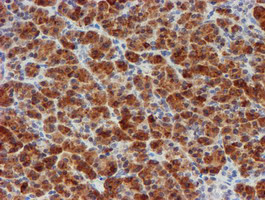 MLF1 Antibody in Immunohistochemistry (Paraffin) (IHC (P))