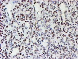 MLF1 Antibody in Immunohistochemistry (Paraffin) (IHC (P))