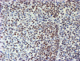 MLF1 Antibody in Immunohistochemistry (Paraffin) (IHC (P))