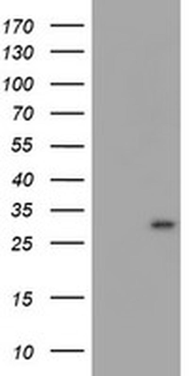 MLF1 Antibody in Western Blot (WB)