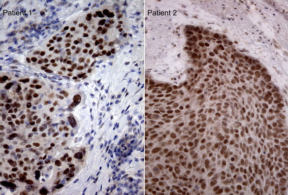 MLH1 Antibody in Immunohistochemistry (Paraffin) (IHC (P))