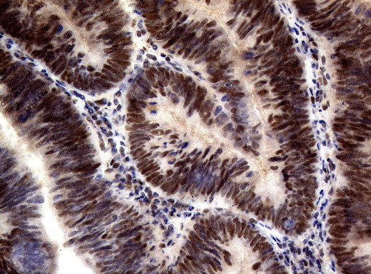 MLH1 Antibody in Immunohistochemistry (Paraffin) (IHC (P))