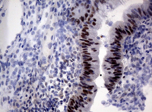 MLH1 Antibody in Immunohistochemistry (Paraffin) (IHC (P))