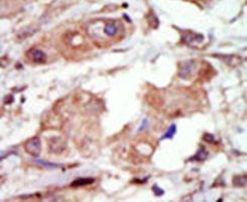 MLK2 Antibody in Immunohistochemistry (IHC)