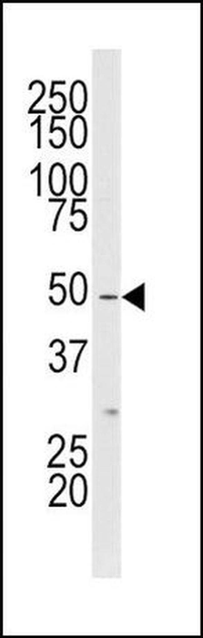 ZAK Antibody in Western Blot (WB)