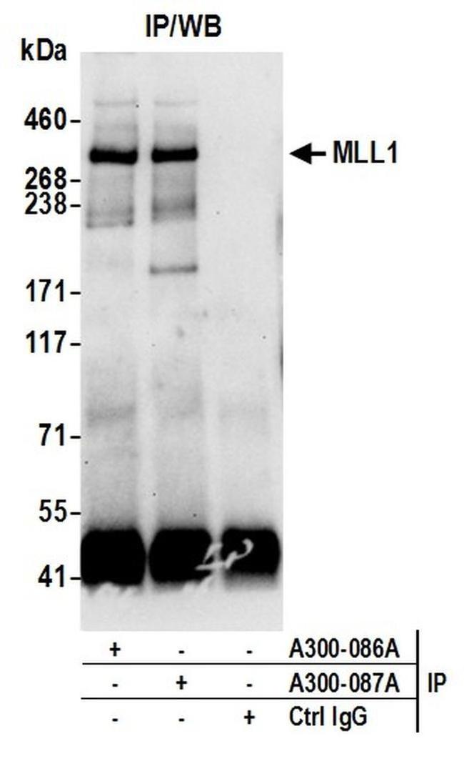 MLL1 Antibody in Western Blot (WB)