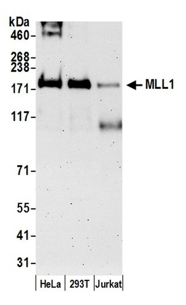 MLL1 Antibody in Western Blot (WB)