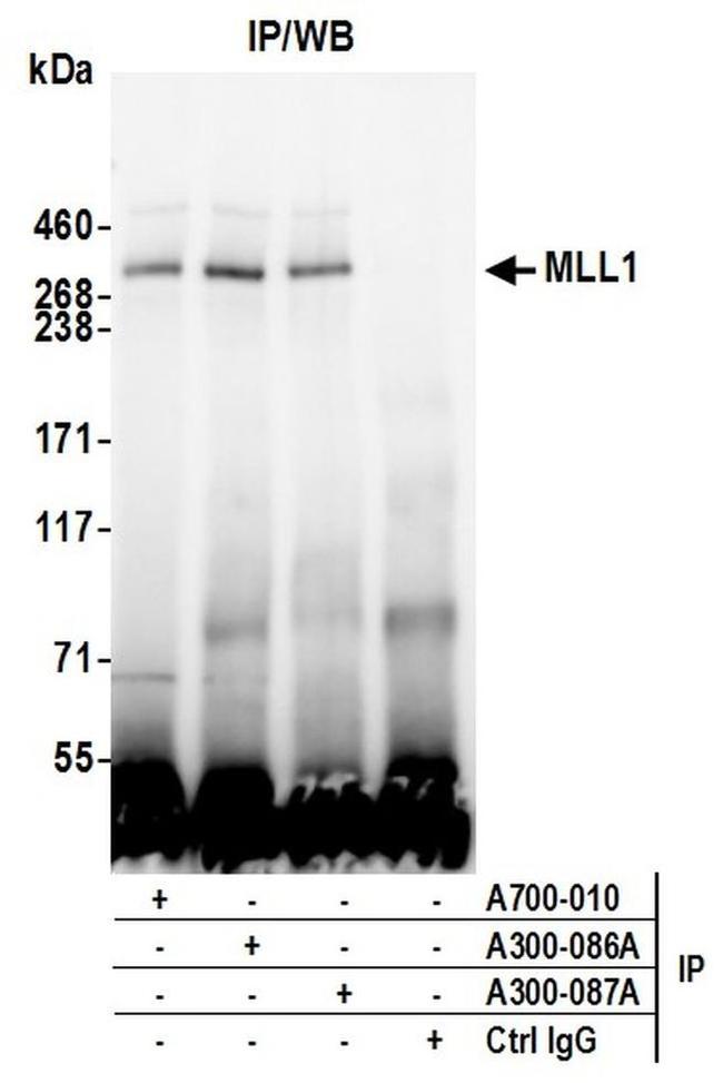 MLL1 Antibody in Western Blot (WB)