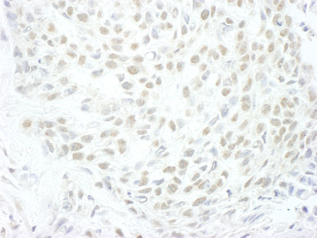 MLLT1 Antibody in Immunohistochemistry (IHC)