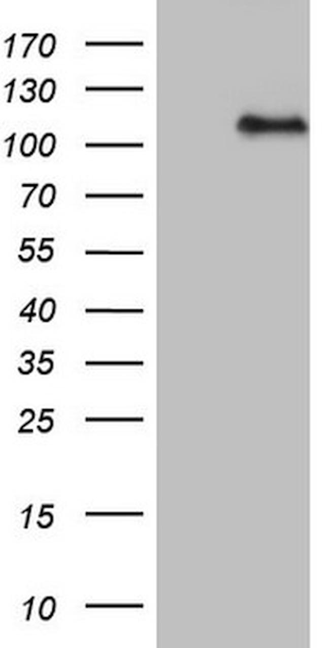 MLLT10 Antibody in Western Blot (WB)