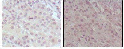 HRX Antibody in Immunohistochemistry (Paraffin) (IHC (P))